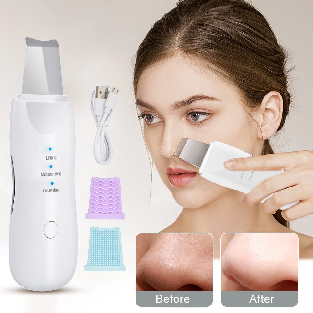Trade Castle Skin care White Ultrasonic Skin Scrubber Deep Face Cleaning Machine Peeling Shovel Facial Pore Cleaner Face Skin Scrubber Lift Beauty Instrument Ultrasonic Facial Scrubber Pore Blackhead Remover Spatula Deep Skin Spa